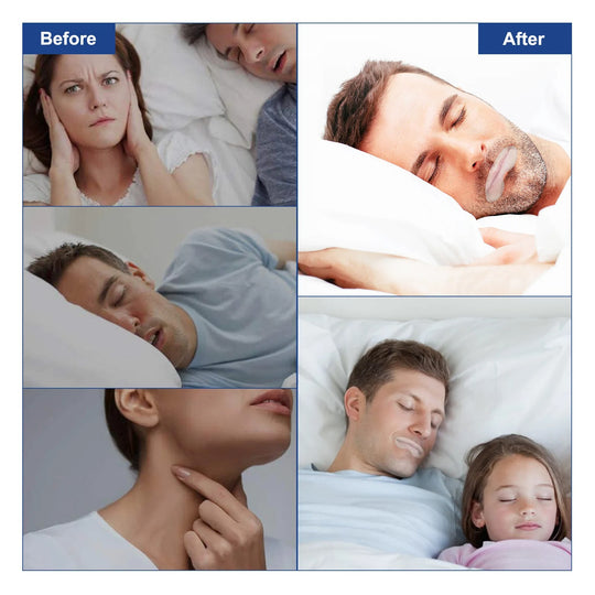 Sleep Strips - Snurk minder & Slaap beter